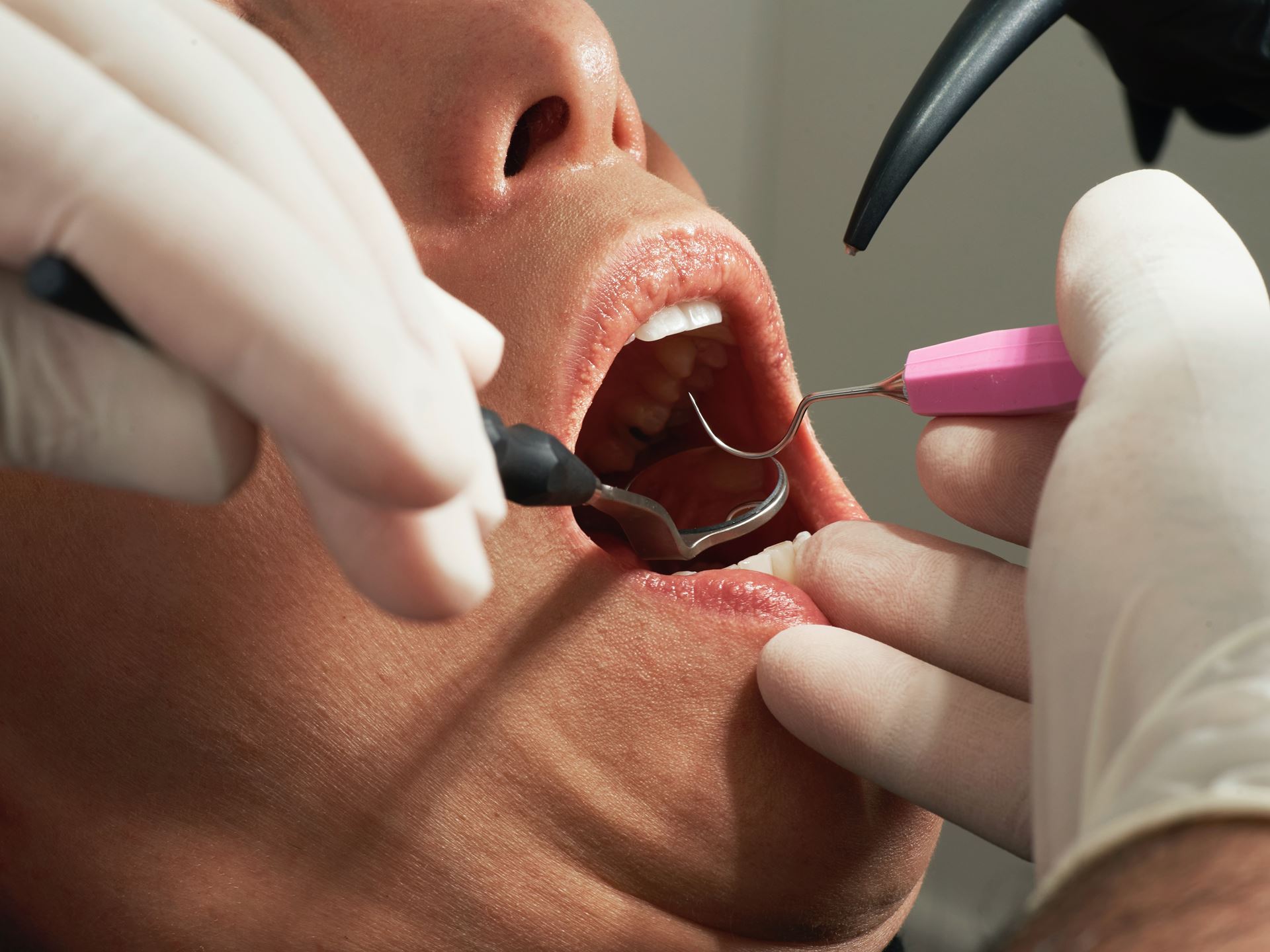 A dentist treating a patient