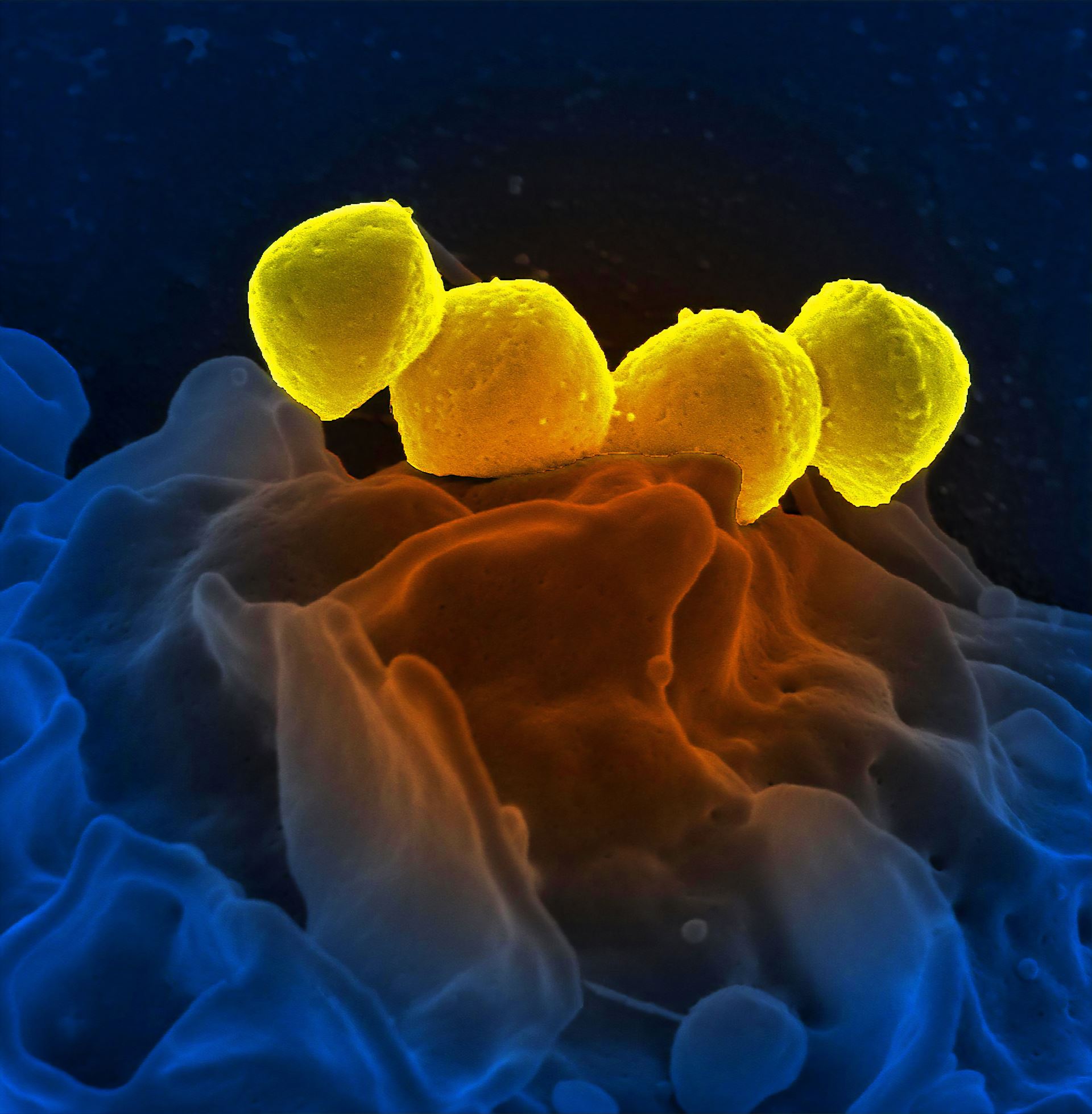 the streptococcus bacteria